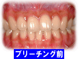 v[`OO